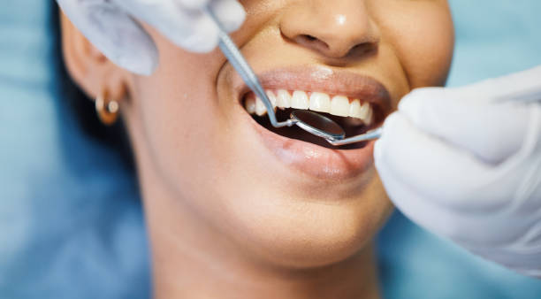Best Emergency Treatment for Oral Infections in Camdenton, MO