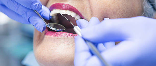 Best Knocked-Out Tooth (Avulsed Tooth) Treatment in Camdenton, MO